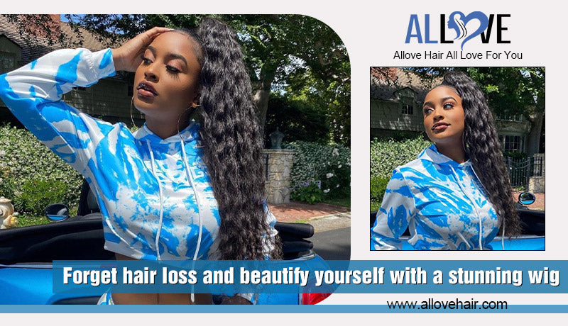 Forget hair loss and beautify yourself with a stunning wig